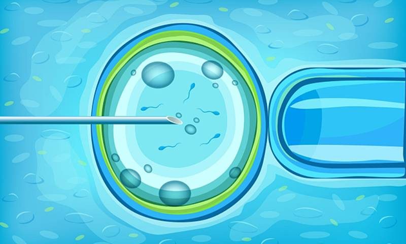 IVF vs. ICSI: Choosing the Right Fertility Treatment for You
